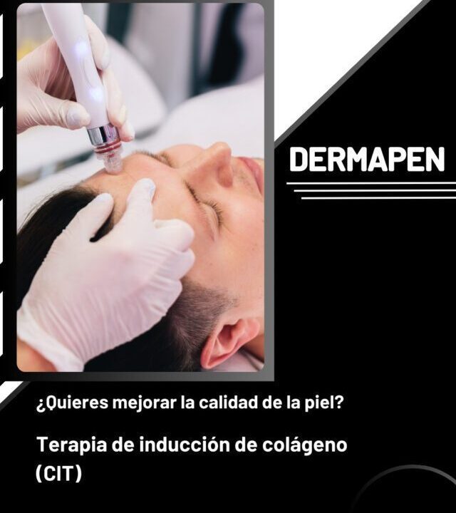 cropped-Dermapen-hombres-pilosso.jpg