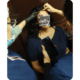 feminizacion-facial-sin-cirugia-pilosso-implante-capilar-buenos-aires-argentina 2024